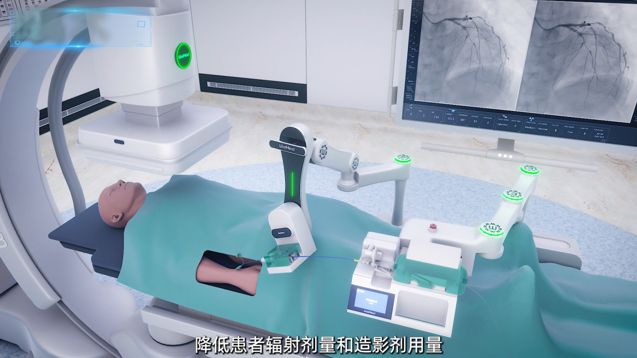 医疗器械动画案例